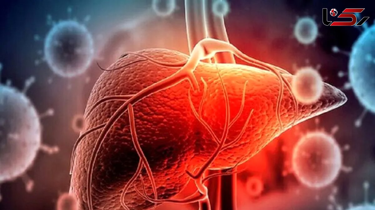 آیا سرطان کبد به قاتل 1/5 میلیون نفر تا سال 2050 تبدیل می شود؟