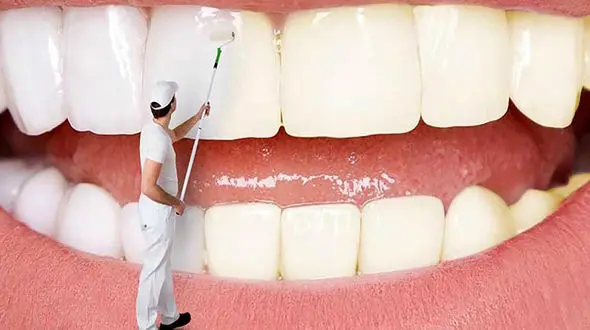 راهکارهای موثر در سفید کردن دندان‌ها