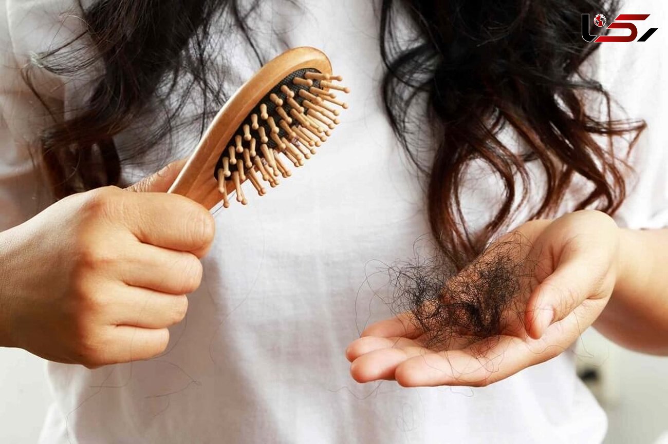 بهترین محصولات ضد ریزش مو؛ با ریزش مو خداحافظی کنید