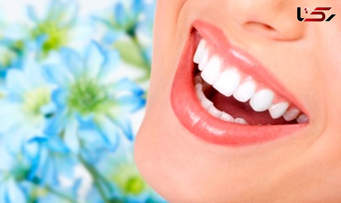 شیوه های خانگی برای داشتن دندان هایی سفید 