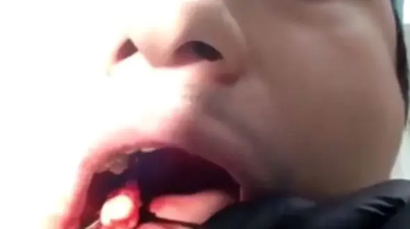 حرفه‌ای‌ترین جراحی دندانی که تا کنون دیده‌اید + فیلم