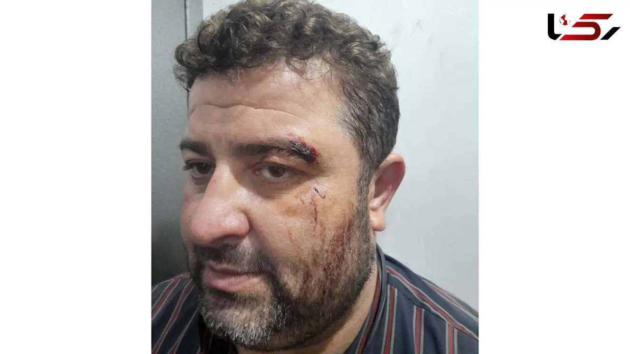 کتک خوردن ماموران یگان حفاظت شفت / قاچاقچیان چوب بی رحم بودند