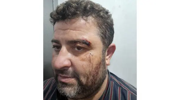 کتک خوردن ماموران یگان حفاظت شفت / قاچاقچیان چوب بی رحم بودند