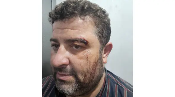 کتک خوردن ماموران یگان حفاظت شفت / قاچاقچیان چوب بی رحم بودند