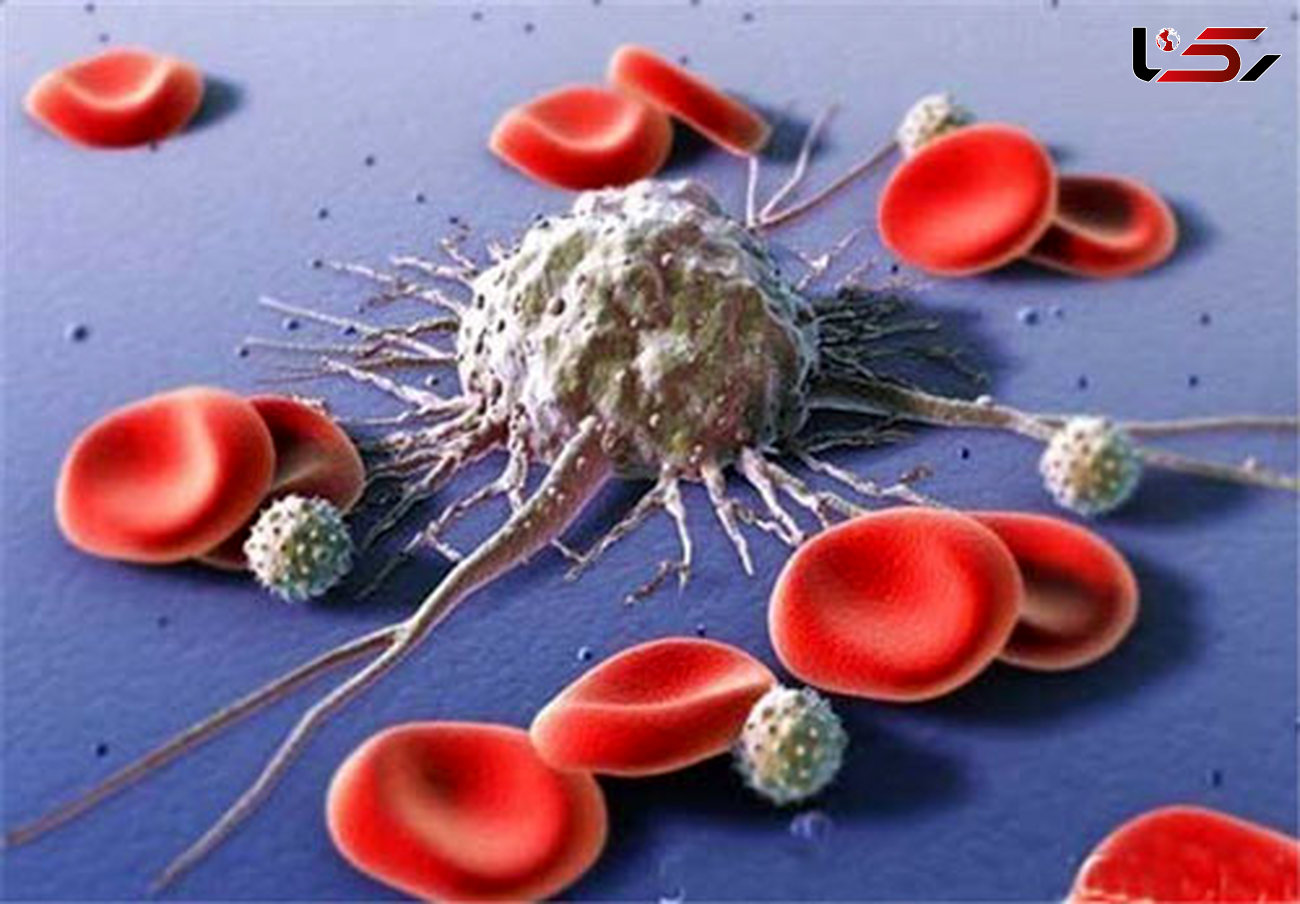   امکان‌ درمان سرطان خون در ایران 