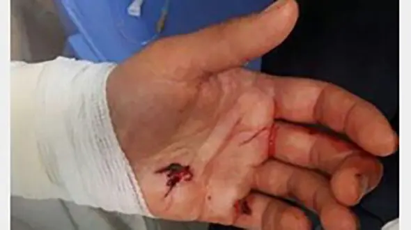 سگ های گله، چوپان اردبیلی را از چنگال پلنگ نجات دادند + عکس