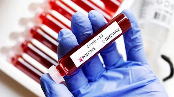 بستری ۶۸ نفر مبتلا به کرونا در استان اردبیل/ ۶ نفر جان باختند