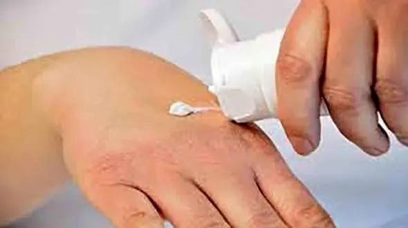 دیگر نگران خشکی دست در زمستان نباشید + درمان