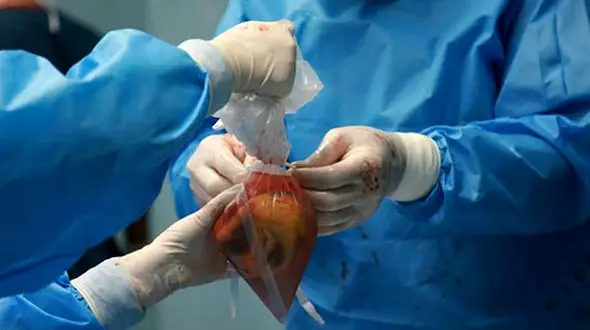 پرواز قلب اهدایی جوان 36 ساله رفسنجانی به تهران 