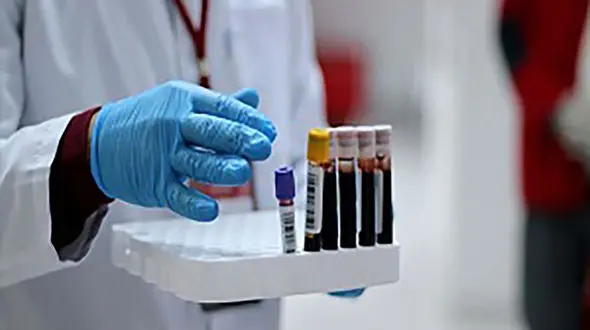 رکورد ابتلا به ویروس کرونا در خوزستان شکسته شد