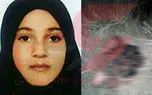 قتل عاطفه 9 ساله برای دزدیدن کلیه هایش ! / قاتل جسد را آتش زد + عکس دختربچه