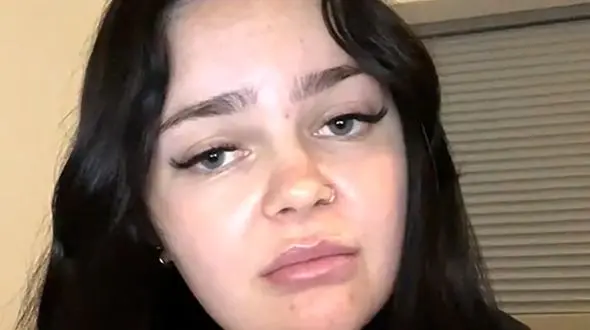 این زن ناگهان شبیه انگری برد شد ! + عکس باورنکردنی