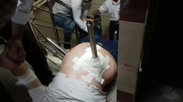 فرورفتن میله نرده به داخل شکم پسر 23 ساله در بوکان + تصاویر (14+) 