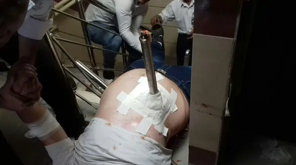 فرورفتن میله نرده به داخل شکم پسر 23 ساله در بوکان + تصاویر (14+) 