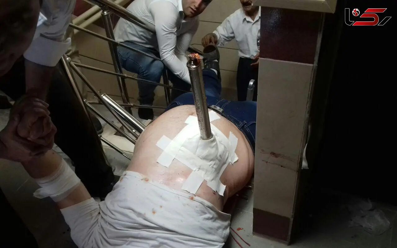 فرورفتن میله نرده به داخل شکم پسر 23 ساله در بوکان + تصاویر (14+) 
