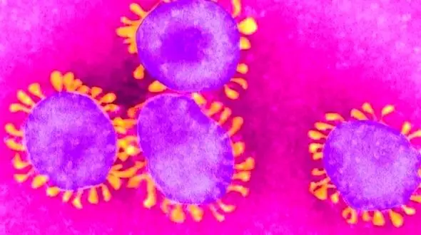 ارتباط ابتلا به کرونا در بارداری با خطر اوتیسم در کودکان