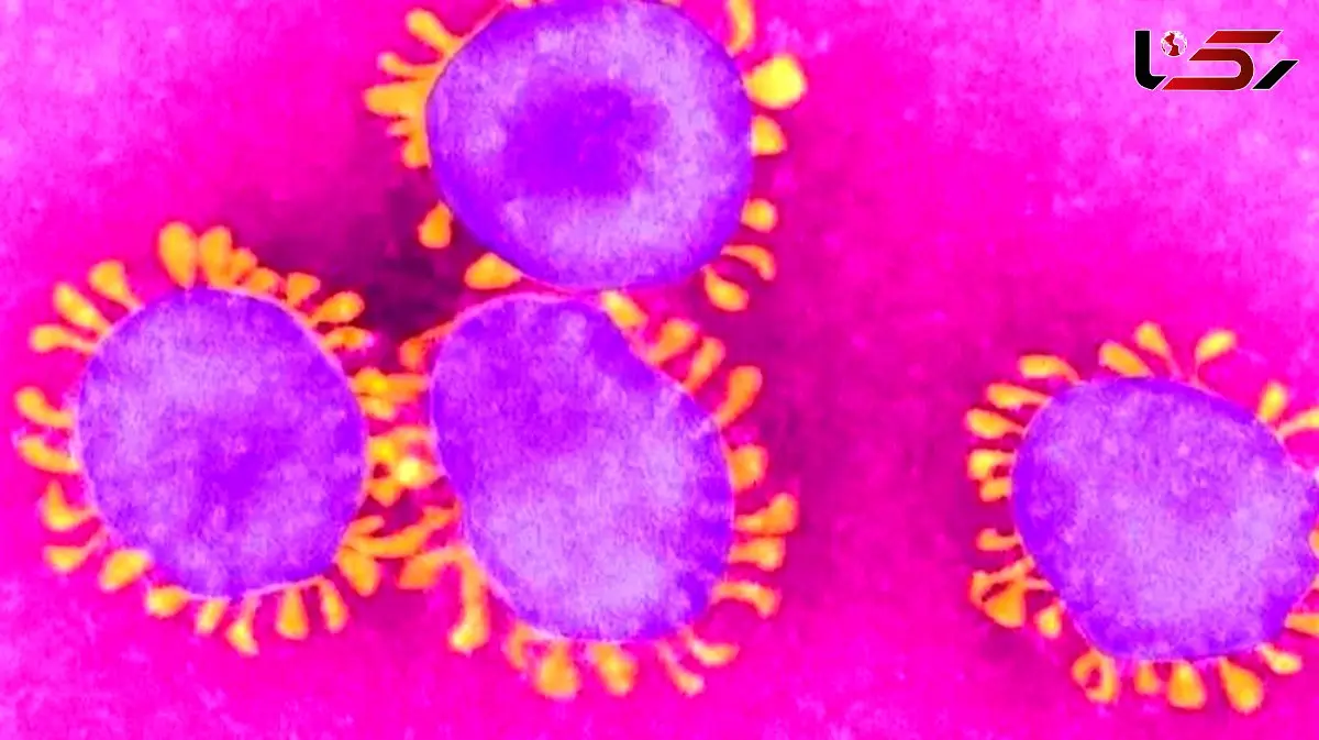 ارتباط ابتلا به کرونا در بارداری با خطر اوتیسم در کودکان