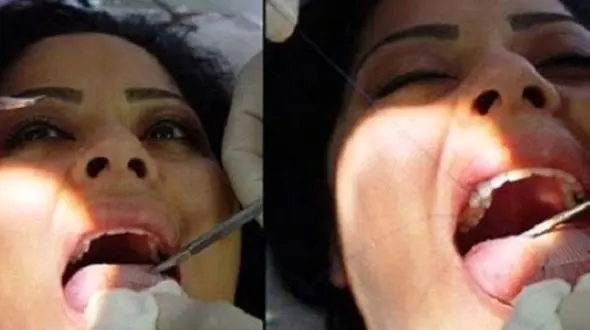 عجیب ترین و دردناک ترین روش لاغری در ونزوئلا 