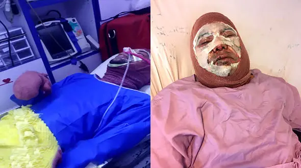 آتش سوزی در آزمایشگاه پردیس ابوریحان دانشگاه تهران / حال دانشجو و کارشناس خوب است