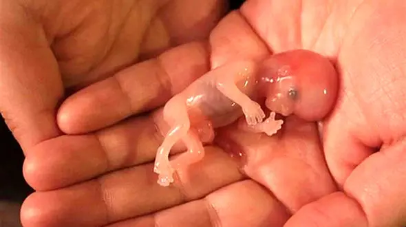 ۴ عامل "سقط جنین"  در ایران!