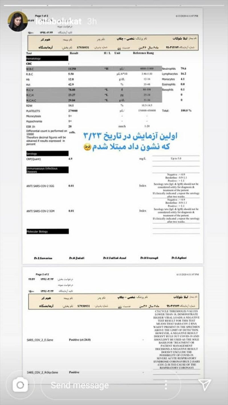 جواب آزمایش هغای کرونای لیلا بلوکات