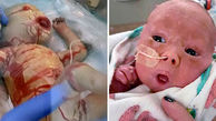 بیماری عجیب پوستی که از این کودک آدم فضایی ساخت (تصاویر +16)