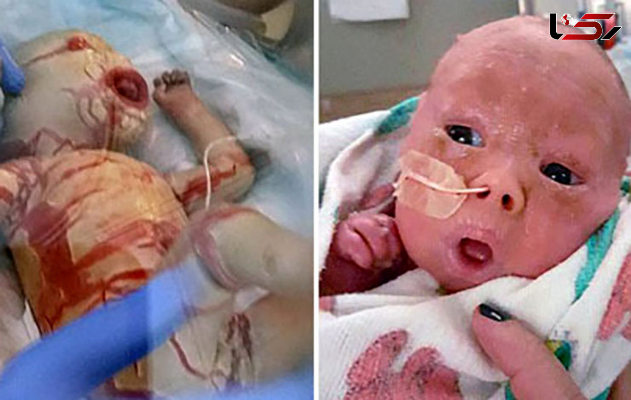 بیماری عجیب پوستی که از این کودک آدم فضایی ساخت (تصاویر +16)