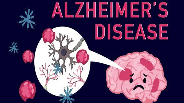 راهکارهای مدیریت استرس در بیماران مبتلا به آلزایمر