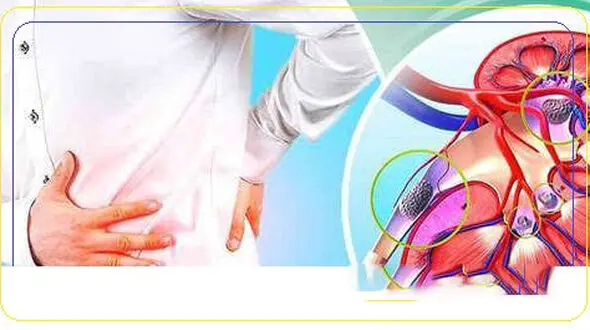 دفع سنگ کلیه بدون جراحی!