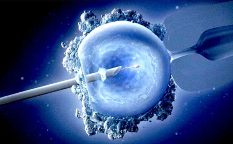 آی وی اف Ivf چیست؟ 