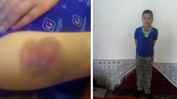 عذرخواهی معلم قزوینی به خاطر تنبیه شاگردش + فیلم گفتگوی اختصاصی