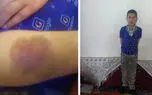 عذرخواهی معلم قزوینی به خاطر تنبیه شاگردش + فیلم گفتگوی اختصاصی