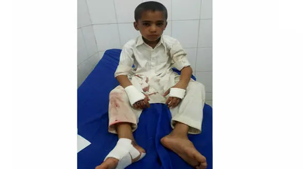 حمله میمون های شیطون به دبستانی در سراوان / 4 کودک مجروح شدند+عکس