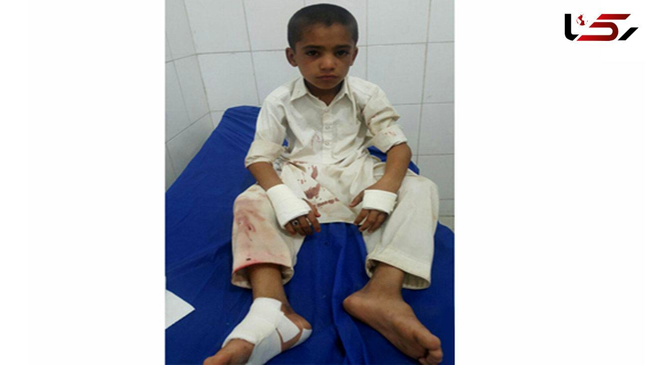 حمله میمون های شیطون به دبستانی در سراوان / 4 کودک مجروح شدند+عکس