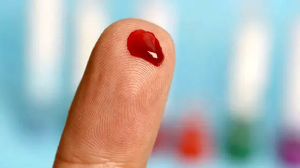 خطر لخته خون در بیماران مبتلا به سرطان پروستات