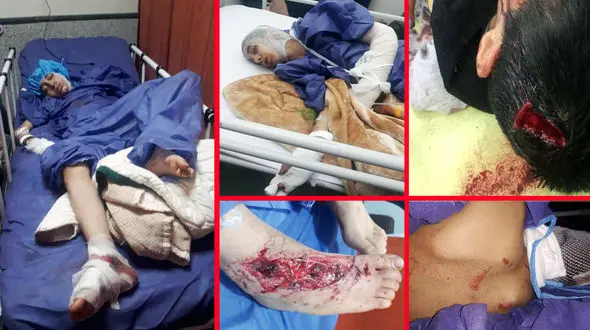 حمله سگ های بدون صاحب به طاها 11 ساله در شهرک زینبیه تهران +عکس دلخراش