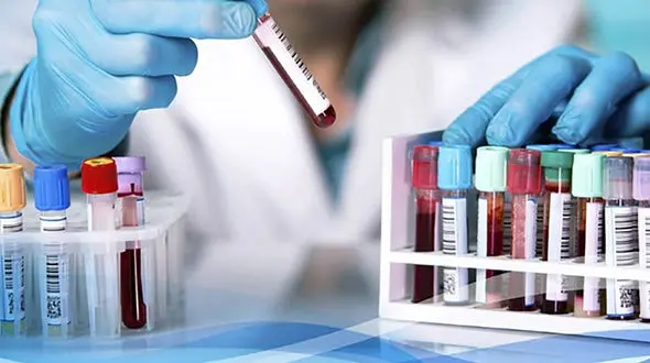 انجمن علوم آزمایشگاهی: متهم پرونده جراحی غیرمجاز هیچ ارتباطی با این رشته ندارد