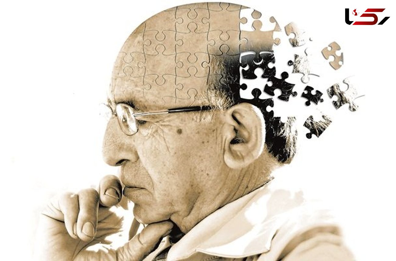 رصد بیماری آلزایمر با یادگیری ماشینی