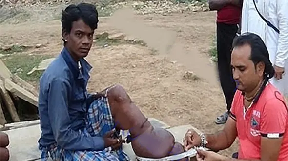 تصاویری هولناک از بیماری عجیب نوجوان هندی