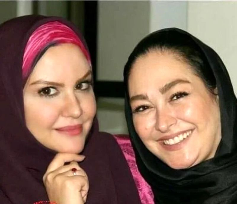 الهام حمیدی قبل از عمل زیبایی