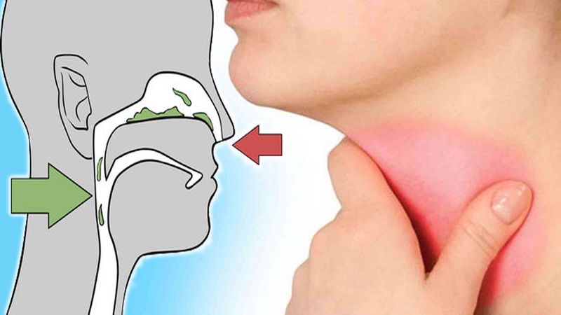 بلغم چیست؟