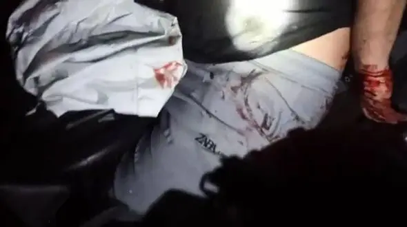 واژگونی خودرو منجر به مبحوس شدن راننده شد + عکس