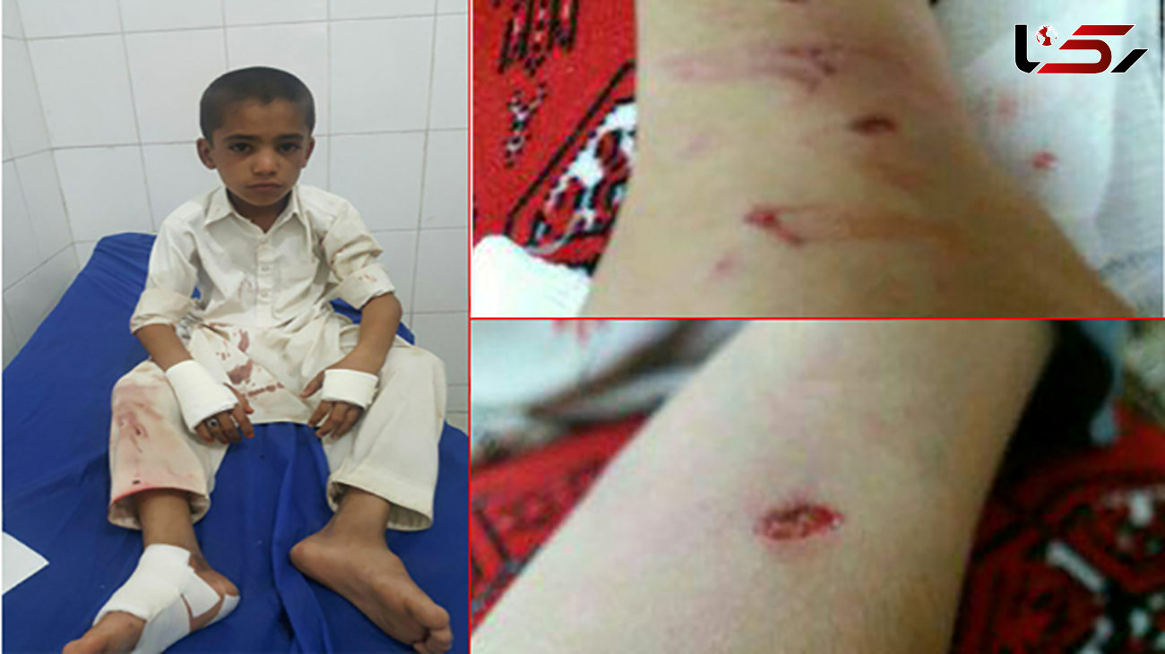 حمله میمون‌های وحشی به 5 پسر بچه دانش آموز در سراوان 