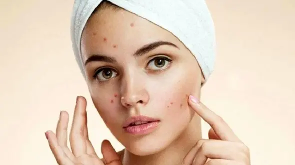 درمان های نوین برای رفع جای جوش