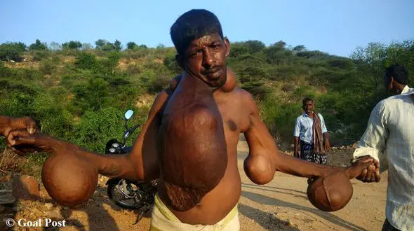 رفتار عجیب مردم روستا با این مرد و شکل و شمایل وحشتناکش ! +تصاویر