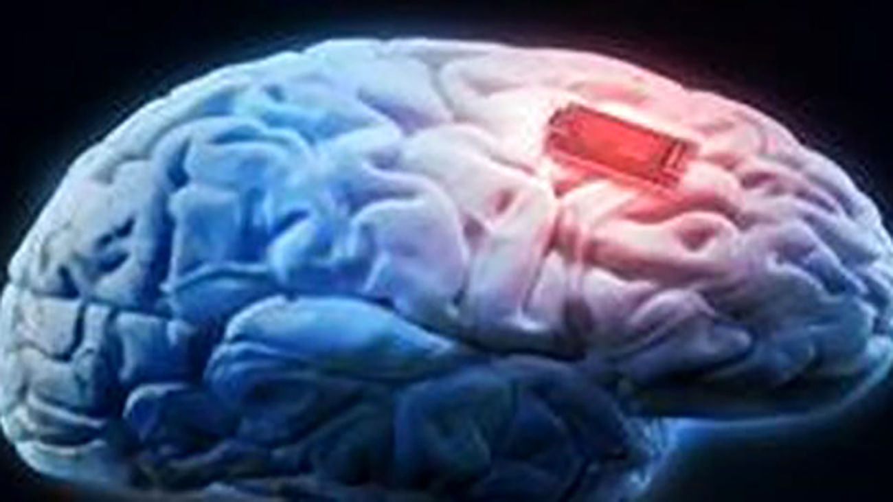 Brain h. Мозговой чип. Чип в мозг. Современные технологии мозг.