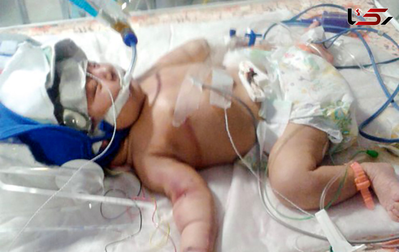 پزشک زنان باعث مرگ نوزاد 3 روزه شد