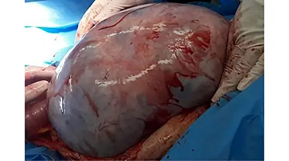 شوکه شدن خانواده کرمانشاهی از شکم برآمده یک زن / آنها چه دیدند؟ 