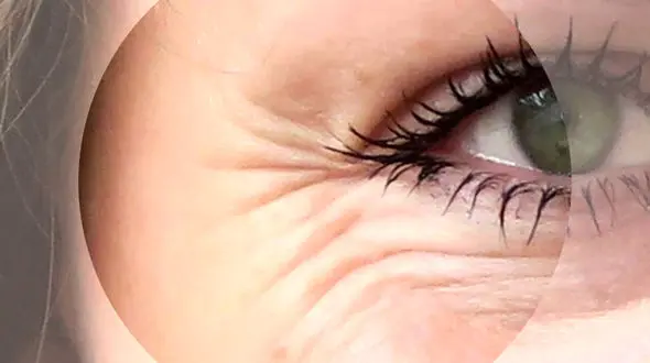 زنگ خطر تغذیه از روی تغییرات پوست