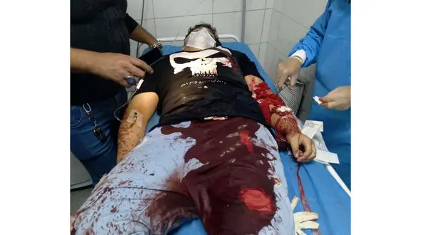 عکس 16+ از پیکر غرق در خون جوان گلستانی / اوباش چه کردند؟ + جزییات 